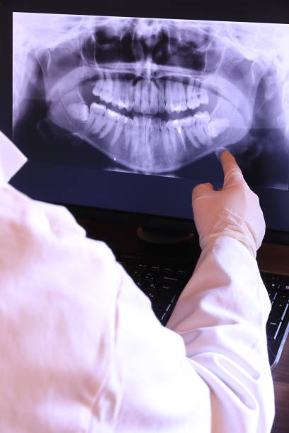 Best Emergency Wisdom Tooth Extraction in Corsicana, TX