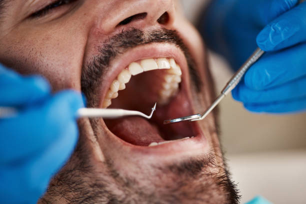Best Emergency Treatment for Oral Infections in Corsicana, TX